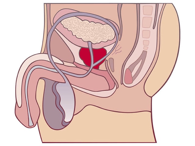 Предстательная железа (простата). Как сохранить здоровой простату