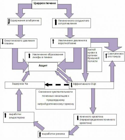 Механизм развития асцита
