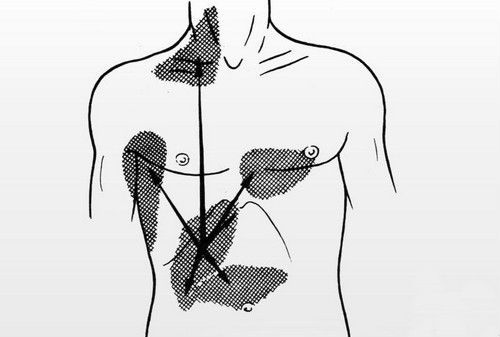 Боли при холецистите